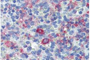 Spleen, Human: Formalin-Fixed, Paraffin-Embedded (FFPE) (CD163 Antikörper)