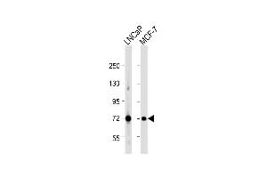 All lanes : Anti-DLAT Antibody (C-term) at 1:1000 dilution Lane 1: LNCaP whole cell lysate Lane 2: MCF-7 whole cell lysate Lysates/proteins at 20 μg per lane. (DLAT Antikörper  (C-Term))