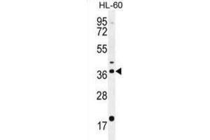 Western Blotting (WB) image for anti-Olfactory Receptor, Family 2, Subfamily W, Member 1-Like (OR2W3) antibody (ABIN2996112) (OR2W3 Antikörper)