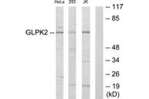 Western blot analysis of extracts from HeLa/293/Jurkat cells, using GK2 Antibody. (GK2 Antikörper  (AA 281-330))