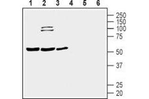 Western blot analysis of human Jurkat T-cell leukemia cell (lanes 1 and 4), human THP-1 monocytic leukemia cell (lanes 2 and 5) and human MEG-01 megakaryoblastic leukemia cell (lanes 3 and 6) lysates: - 1-3. (Prostacyclin Receptor Antikörper  (3rd Extracellular Loop))
