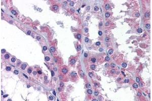 Human Kidney: Formalin-Fixed, Paraffin-Embedded (FFPE) (AKT3 Antikörper  (AA 119-136))