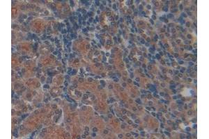 Used in DAB staining on fromalin fixed paraffin- embedded kidney tissue
