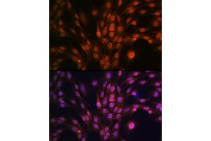 Immunofluorescence analysis of C6 cells using P antibody (ABIN7269146) at dilution of 1:100. (PAK2 Antikörper)