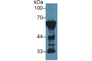 Detection of CaN in Rat Cerebrum lysate using Polyclonal Antibody to Calcineurin (CaN) (CAN Antikörper  (AA 7-301))