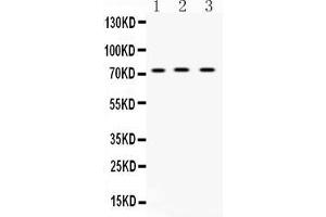 Western blot analysis of ABCG8 expression in rat liver extract ( Lane 1), mouse liver extract ( Lane 2) and human placenta extract ( Lane 3). (ABCG8 Antikörper  (Middle Region))