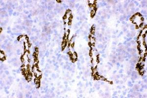 IHC analysis of HSD11B2 using anti-HSD11B2 antibody (ABIN3043846). (HSD11B2 Antikörper  (C-Term))
