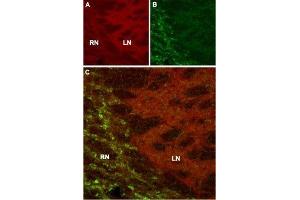 Expression of HCN4 in mouse thalamus - Immunohistochemical staining of mouse thalamus using Anti-HCN4 Antibody (ABIN7043284, ABIN7044963 and ABIN7044964).