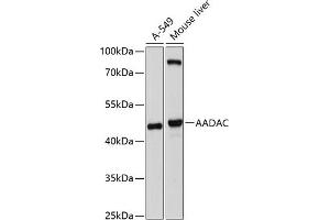 Western blot analysis of extracts of various cell lines, using AADAC antibody (ABIN6129181, ABIN6136310, ABIN6136312 and ABIN6214595) at 1:1000 dilution. (AADAC Antikörper  (AA 170-399))