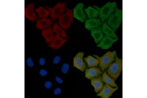 ABIN6257012 and ABIN6274964 staining Hela cells(45 min of heat-shock) by IF/ICC. (CBR1 Antikörper  (C-Term))