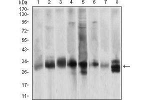 Western blot analysis using CASP3 mouse mAb against Hela (1), Jurkat (2), HepG2 (3), BCL-1 (4), C6 (5), SK-Br-3 (6), NIH/3T3 (7) and A549 (8) cell lysate.