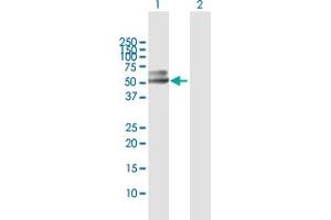 Western Blot analysis of PSAP expression in transfected 293T cell line by PSAP MaxPab polyclonal antibody.