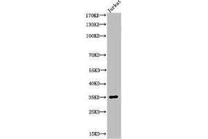 Western Blot analysis of JK cells using Acetyl-Ref-1 (K7) Polyclonal Antibody (APEX1 Antikörper  (acLys7))
