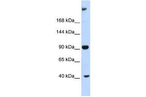 WB Suggested Anti-MPDZ Antibody Titration:  0. (MPDZ Antikörper  (Middle Region))