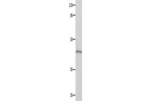 Gel: 10 % SDS-PAGE, Lysate: 40 μg, Lane: Mouse eyes tissue, Primary antibody: ABIN7129618(GNA11 Antibody) at dilution 1/550, Secondary antibody: Goat anti rabbit IgG at 1/8000 dilution, Exposure time: 10 seconds