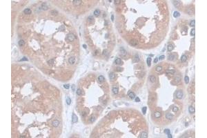 Immunohistochemistry (IHC) image for anti-Uncoupling Protein 2 (Mitochondrial, Proton Carrier) (UCP2) (AA 154-289) antibody (ABIN7428086)