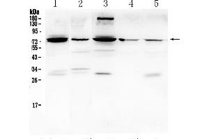Western blot analysis of PTGS2 using anti- PTGS2 antibody . (PTGS2 Antikörper  (Middle Region))