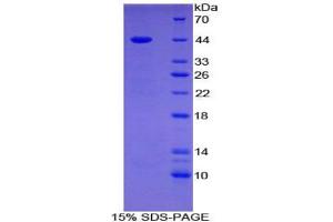 SDS-PAGE analysis of Human Gastrin Protein. (Gastrin Protein (GAST))