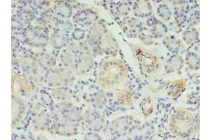 Immunohistochemistry of paraffin-embedded human pancreatic tissue using ABIN7150385 at dilution of 1:100 (RFX6 Antikörper  (AA 1-260))
