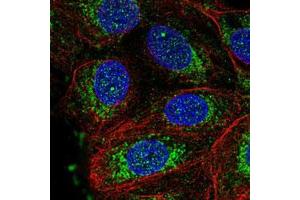 Immunofluorescent staining of MCF7 cells with NDUFS3 polyclonal antibody  (Green) shows positivity in nucleus and mitochondria.