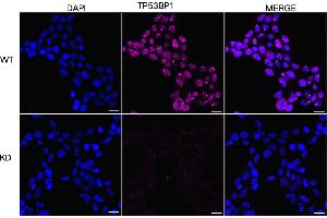 Immunocytochemical staining of HeLa cells using TP53BP1 antibody (ABIN7800690), 1:1,000), Top panel: wild-type (WT), Bottom panal: TP53BP1 shRNA knockdown (KD). (TP53BP1 Antikörper)