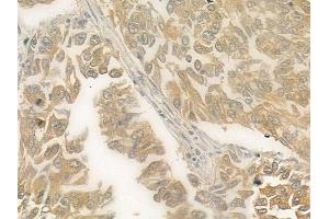 ABIN6257879 and ABIN6275537 at 1/100 staining human normal kidney tissue by IHC-P. (PRKX Antikörper  (Internal Region))