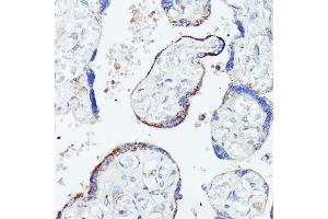 Immunohistochemistry of paraffin-embedded human placenta using HSPB11 antibody (ABIN7267591) at dilution of 1:100 (40x lens). (HSPB11 Antikörper)