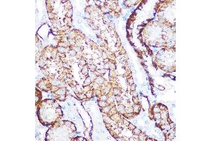 Immunohistochemistry of paraffin-embedded mouse kidney using NDRG1 Rabbit mAb (ABIN7268783) at dilution of 1:100 (40x lens). (NDRG1 Antikörper)