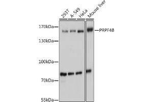 Western blot analysis of extracts of various cell lines, using PRPF4B antibody (ABIN7270232) at 1:1000 dilution. (PRPF4B Antikörper  (AA 550-760))