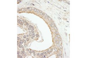 Immunohistochemistry (IHC) image for anti-ATP-Binding Cassette, Sub-Family F (GCN20), Member 2 (ABCF2) (AA 573-623) antibody (ABIN7454542)