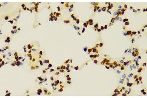 Immunohistochemistry of paraffin-embedded Mouse lung using DiMethyl-Histone H3-K4 Polyclonal Antibody at dilution of 1:100 (40x lens).