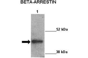 Sample Type :  Lane 1: 20ug mouse left ventricle heart lysate  Primary Antibody Dilution :   1:1000  Secondary Antibody:  Anti-rabbit-HRP  Secondary Antibody Dilution:   1:5000  Color/Signal Descriptions:  ARRB2  Gene Name:  Kathleen Gabrielson  Submitted by: (Arrestin 3 Antikörper  (Middle Region))