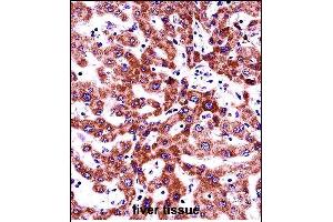 ITGB5 Antibody (N-term) (ABIN657921 and ABIN2846868) immunohistochemistry analysis in formalin fixed and paraffin embedded human liver tissue followed by peroxidase conjugation of the secondary antibody and DAB staining. (Integrin beta 5 Antikörper  (N-Term))