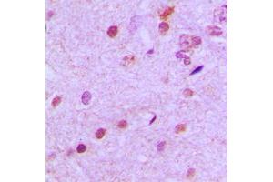 Immunohistochemical analysis of NEUROD2 staining in human brain formalin fixed paraffin embedded tissue section.
