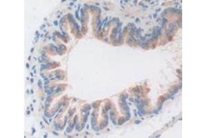 Immunohistochemistry (IHC) image for anti-Caspase 1 (CASP1) (AA 119-296) antibody (ABIN1174809)