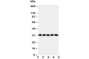 Western blot testing of LOX-1 antibody and Lane 1:  HeLa;  2: SMMC-7721;  3: U87;  4: U937;  5: K562 lysate. (OLR1 Antikörper  (N-Term))