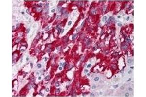 Image no. 1 for anti-Deleted in Liver Cancer 1 (DLC1) (Isoform 1), (Isoform 3), (N-Term) antibody (ABIN452680) (DLC1 Antikörper  (Isoform 1, Isoform 3, N-Term))