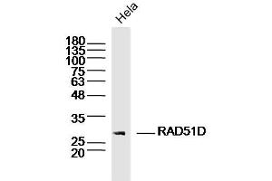 Hela lysates probed with RAD51D Polyclonal Antibody, Unconjugated  at 1:300 dilution and 4˚C overnight incubation. (RAD51D Antikörper  (AA 1-100))