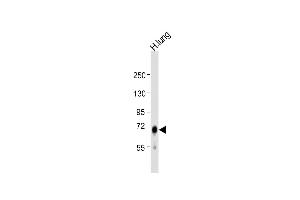 Anti-IDUA Antibody (Center) at 1:1000 dilution + human lung lysate Lysates/proteins at 20 μg per lane. (IDUA Antikörper  (AA 236-264))