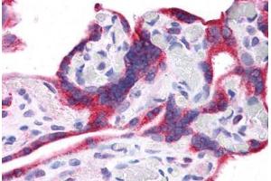 Human Placenta: Formalin-Fixed, Paraffin-Embedded (FFPE) (Leptin Antikörper  (N-Term))