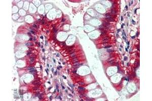 IHC staining of FFPE human small intestine with NRAS antibody at 2. (GTPase NRas Antikörper)