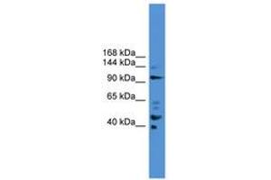 Image no. 1 for anti-Progesterone Immunomodulatory Binding Factor 1 (PIBF1) (AA 601-650) antibody (ABIN6745470) (PIBF1 Antikörper  (AA 601-650))