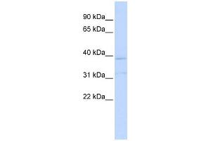 WB Suggested Anti-KCNK15 Antibody Titration:  0. (KCNK15 Antikörper  (Middle Region))