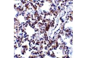 Immunohistochemistry (IHC) image for anti-B-Cell Receptor-Associated Protein 31 (BCAP31) (C-Term) antibody (ABIN1030283) (BCAP31 Antikörper  (C-Term))