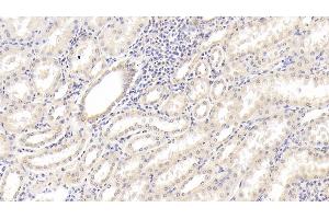 Detection of IL18 in Human Kidney Tissue using Monoclonal Antibody to Interleukin 18 (IL18) (IL-18 Antikörper  (AA 94-193))