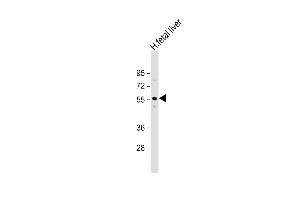 Anti-ACVR2A Antibody (N-term) at 1:1000 dilution + human fetal liver lysate Lysates/proteins at 20 μg per lane.