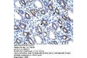 Human kidney (RGS6 Antikörper  (C-Term))