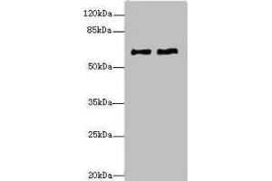 Western blot All lanes: COL9A3antibody at 1. (COL9A3 Antikörper  (AA 445-684))