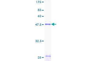 Surfactant Protein C Protein (SFTPC) (AA 1-197) (GST tag)