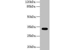 Western blot All lanes: CYB5R2 antibody at 4 μg/mL + Mouse kidney tissue Secondary Goat polyclonal to rabbit IgG at 1/10000 dilution Predicted band size: 32, 28 kDa Observed band size: 32 kDa (CYB5R2 Antikörper  (AA 1-237))